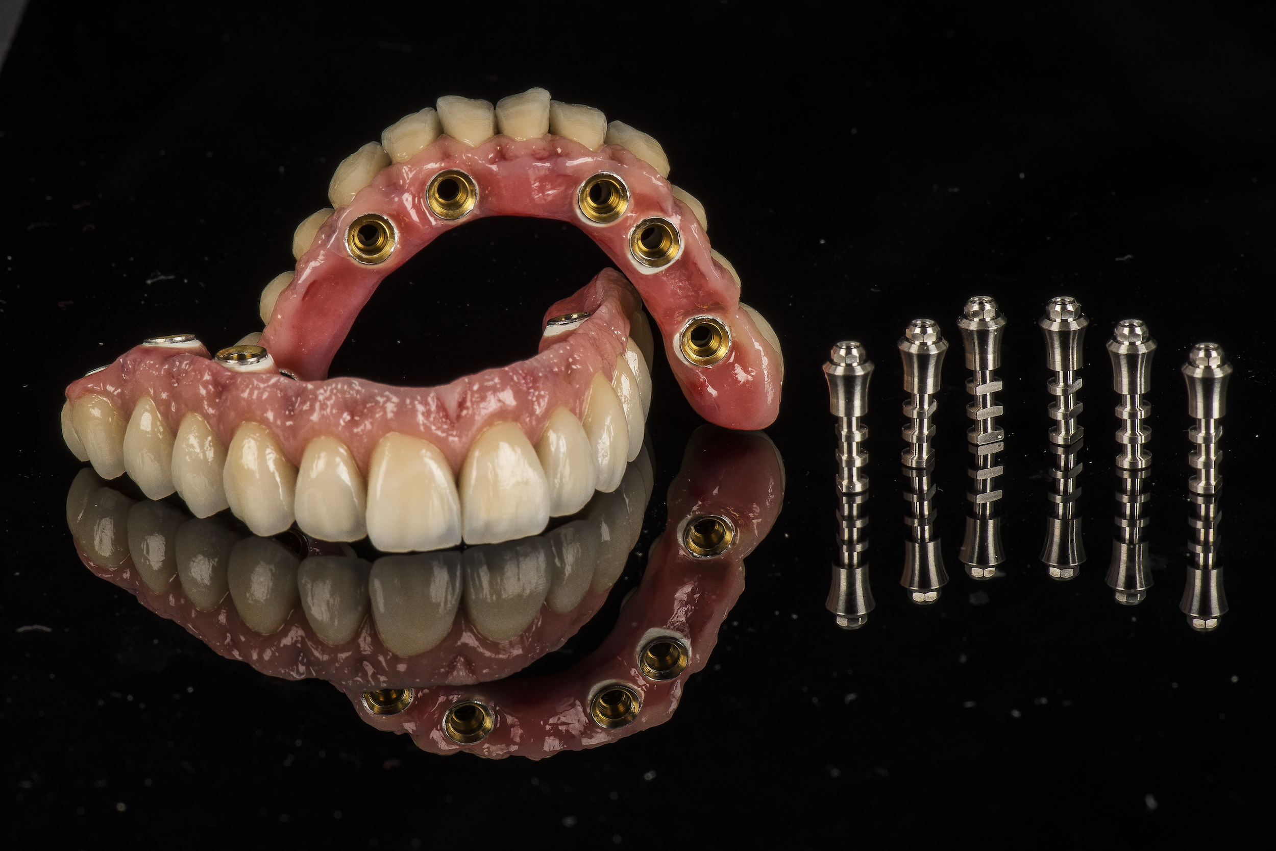 Rehabilitación sobre implantes con estructura CAD-CAM